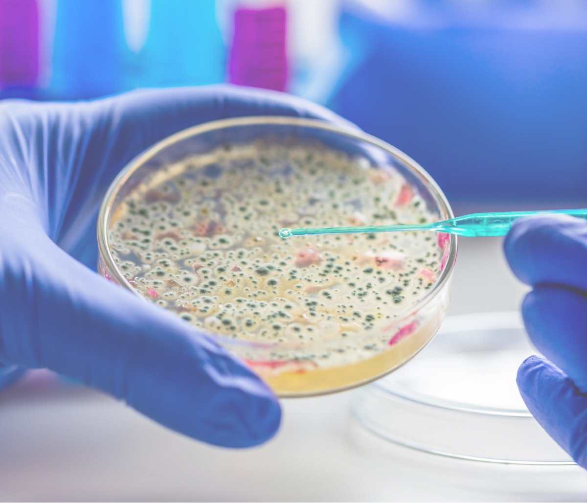 Cómo aprovechar al máximo el agar para medios de cultivo